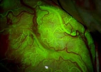 Доставят лекарства  в мозъка с ултразвук